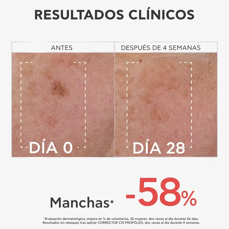 Apivita C15 Propolis Correct Corrective Serum, 30 ml - Image 9