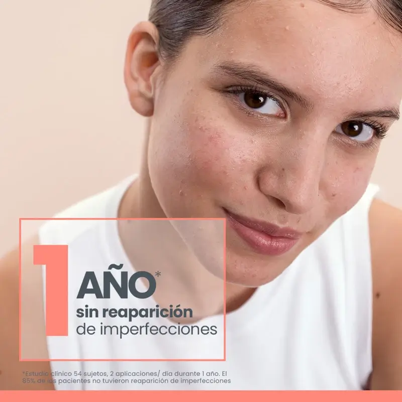 Avène Cleanance Comedomed Anti-Imperfection Concentrate, 30 ml - Image 4