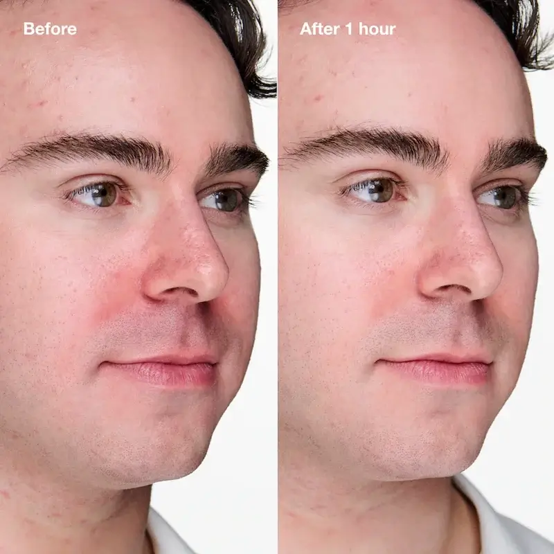 Clinique Anti-Blemish Solutions Clinical Advanced Cleansing Gel, 20 ml - Image 6